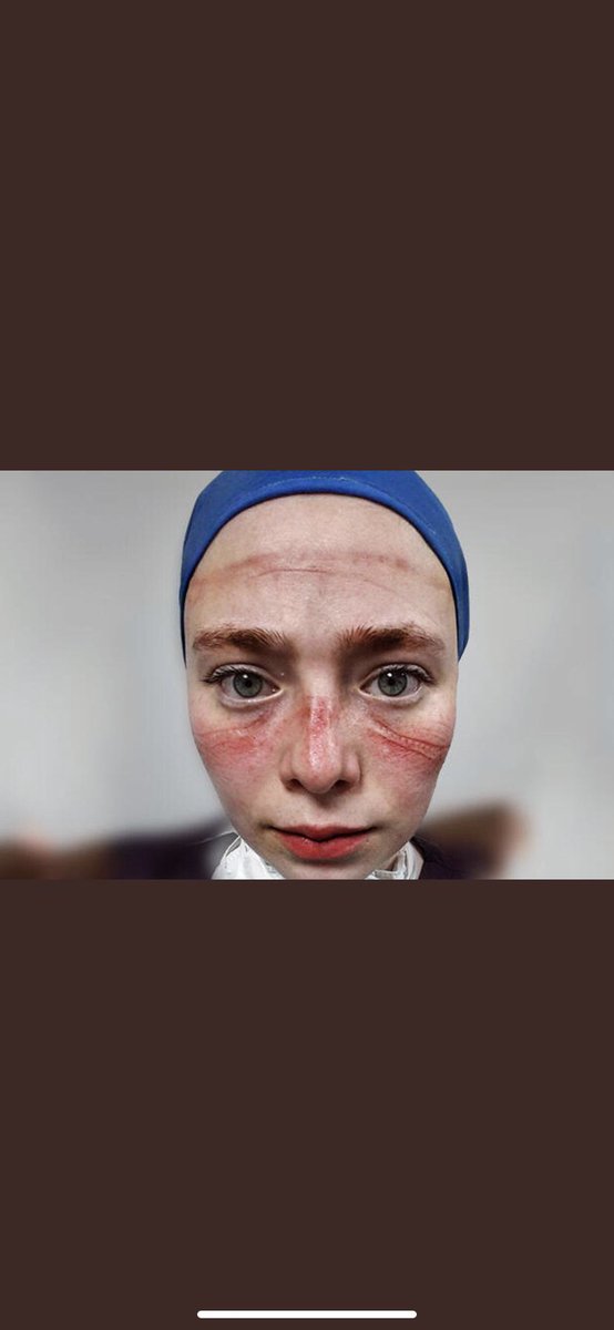 #SağlıkçıİşBırakıyor Sağlık çalışanı değilmişiz🤔biz kimiz o zaman? Pandemi sürecinde birebir hasta ile temasta olup sahada gece gündüz demeden ailemizi tehlikeye atarak mücadele eden,sokak sokak gezip aşı yapan HEMŞİRELERDİK. Yoğunbakımlarda hasta başında bekleyen yine bizdik..