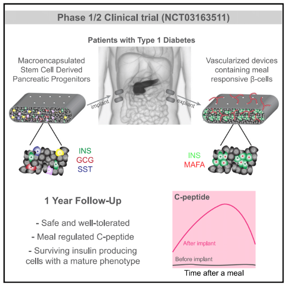 CellPressNews's tweet photo. Stem cell based implants successfully secrete #insulin in patients with type 1 #diabetes. These phase I/II clinical trial data in @CellStemCell &amp; @CellRepMed are the first evidence of meal-regulated insulin secretion by differentiated stem cells in human patients. Papers below!🧵 https://t.co/95RhFfFKj9