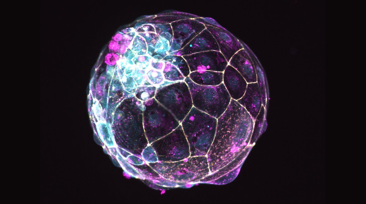 IMBA_Vienna's tweet photo. For more on the Rivron lab at IMBA @NRivron: https://t.co/r49avhgWHT
#blastoid #embryomodel #development #syntheticdevelopment
(3/3) https://t.co/V0e1ZoaeIL
