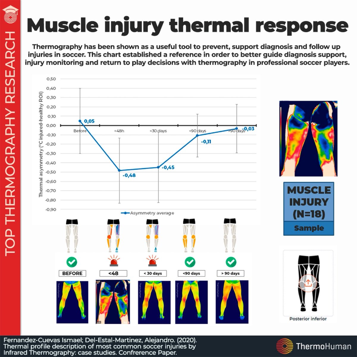 ThermoHuman's tweet photo. 🇬🇧
🤔 What happens when a #muscleinjury occurs from thermal perspective?

🔥 A warmer reaction?

❄️ In this post we can see the most recent findings showing how #muscle injuries are the opposite: hypothermic.
👉https://t.co/bSZCyzWMEv

#thermography #thermohuman https://t.co/zxryfq4Kqp