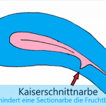 Photo by Kinderwunsch Forum (@kiwufeed)