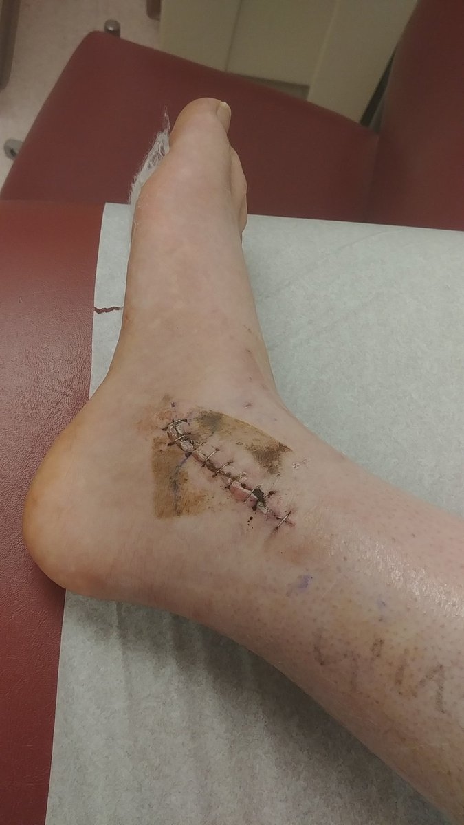 yungbluzi's tweet photo. Yall said "feet pics" and I listened 🙏 https://t.co/WUJ7NJd4Fr