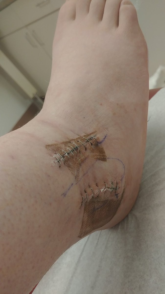 yungbluzi's tweet photo. Yall said "feet pics" and I listened 🙏 https://t.co/WUJ7NJd4Fr