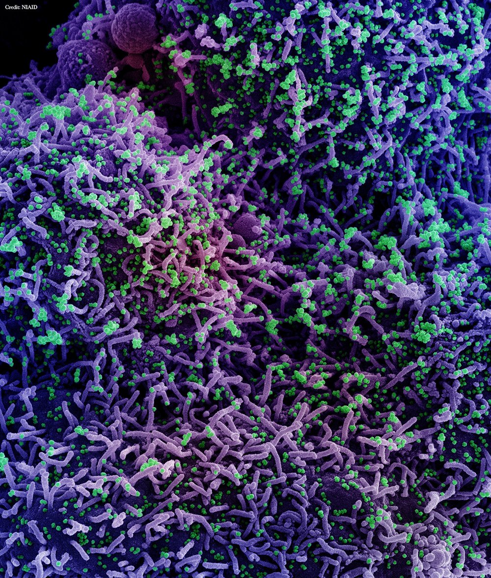 A new study of healthcare workers in the United Kingdom shows that populations infected with #SARSCoV2 during waves of different variants carry distinct immune memory, which may lead to differential protection against future variants of concern. fcld.ly/ur54kjx