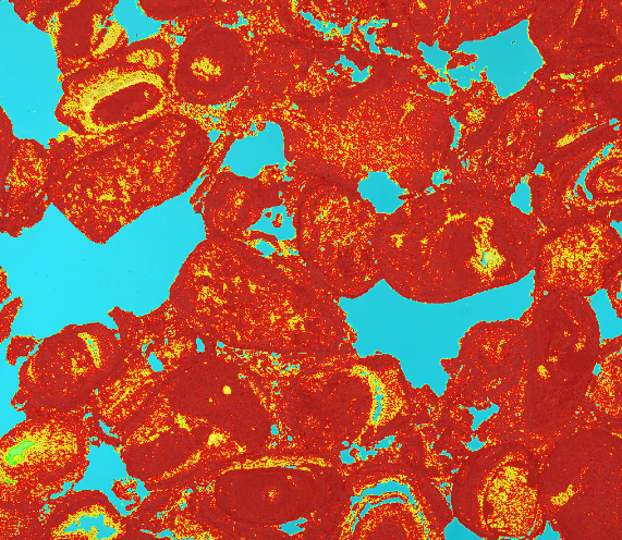 LTraceGeo's tweet photo. Check out the new version of the GeoSlicer environment for Thin Sections segmentation and analysis.
GeoSlicer is based on @3DSlicerApp 
https://t.co/vpp63N5Qgq https://t.co/3NPneLR92z