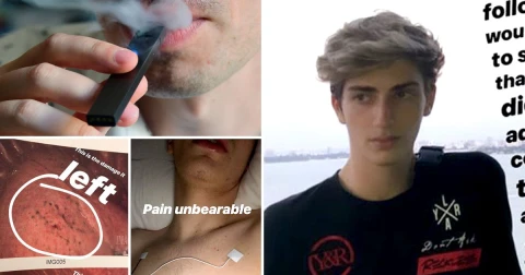 MitochondriaNow's tweet photo. Student, 18, says vaping almost killed him after lung collapse. He wants all teens around the US to know the risk. Will you listen? https://t.co/PaomnYw4ES
