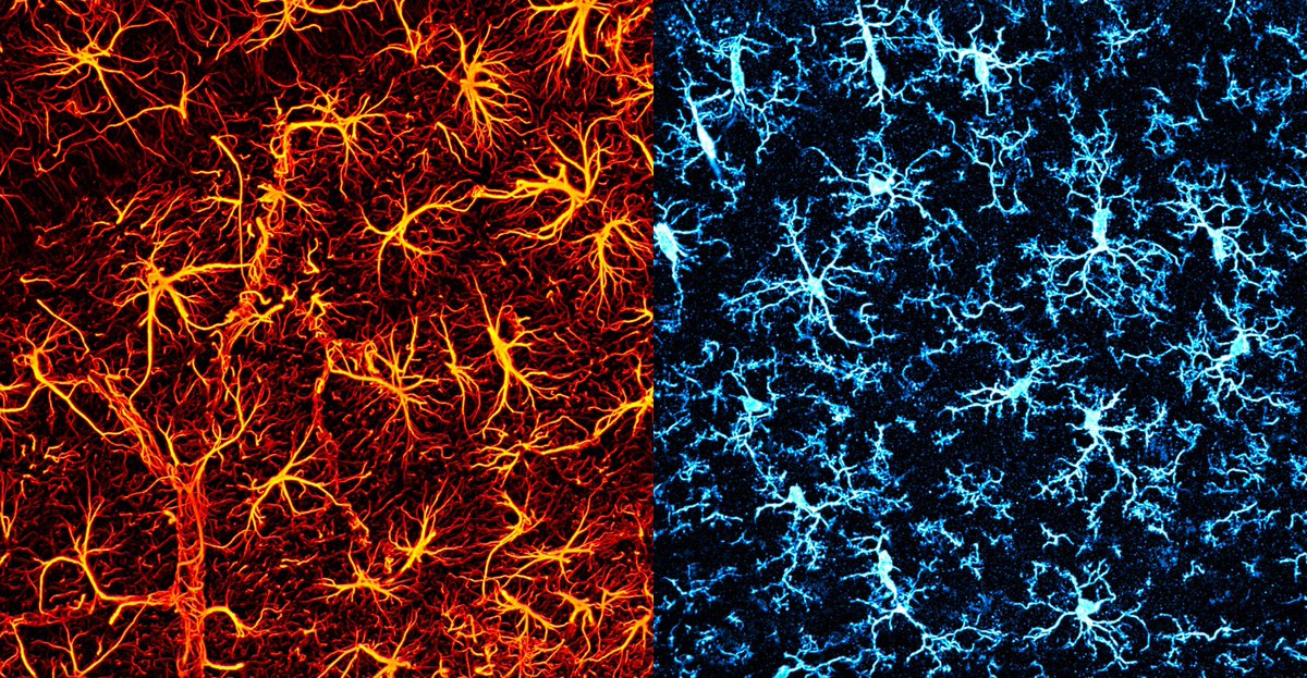 CeliaLuchena's tweet photo. No context glial cells. Hot astrocytes on the left, snowflake microglia on the right 😁 #glia #neuroscience @MatuteLab @AchucarroGlia https://t.co/SR2ZF9sHrH