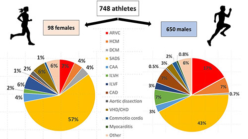 #ResearchLetter In a large UK registry, >50% of female athletes with sudden cardiac death had structurally normal hearts, suggestive of an etiology of sudden arrhythmic death syndrome <a href="/BehrElijah/">Elijah Behr</a> <a href="/DrRaghavBhatia/">Raghav Bhatia</a> #AHAJournals 
ow.ly/Tm1150H0WTE