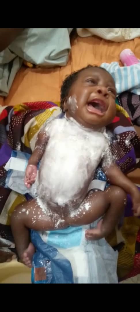 PlumeInfos's tweet photo. Kin-S.O.S:née par césarienne et avc malformation,  l'enfant et sa maman sont retenues ds 1hôpital  pr manque des moyens.Urgence pr des soins appropriés  +243 997254505 https://t.co/nW9DTn3qK7