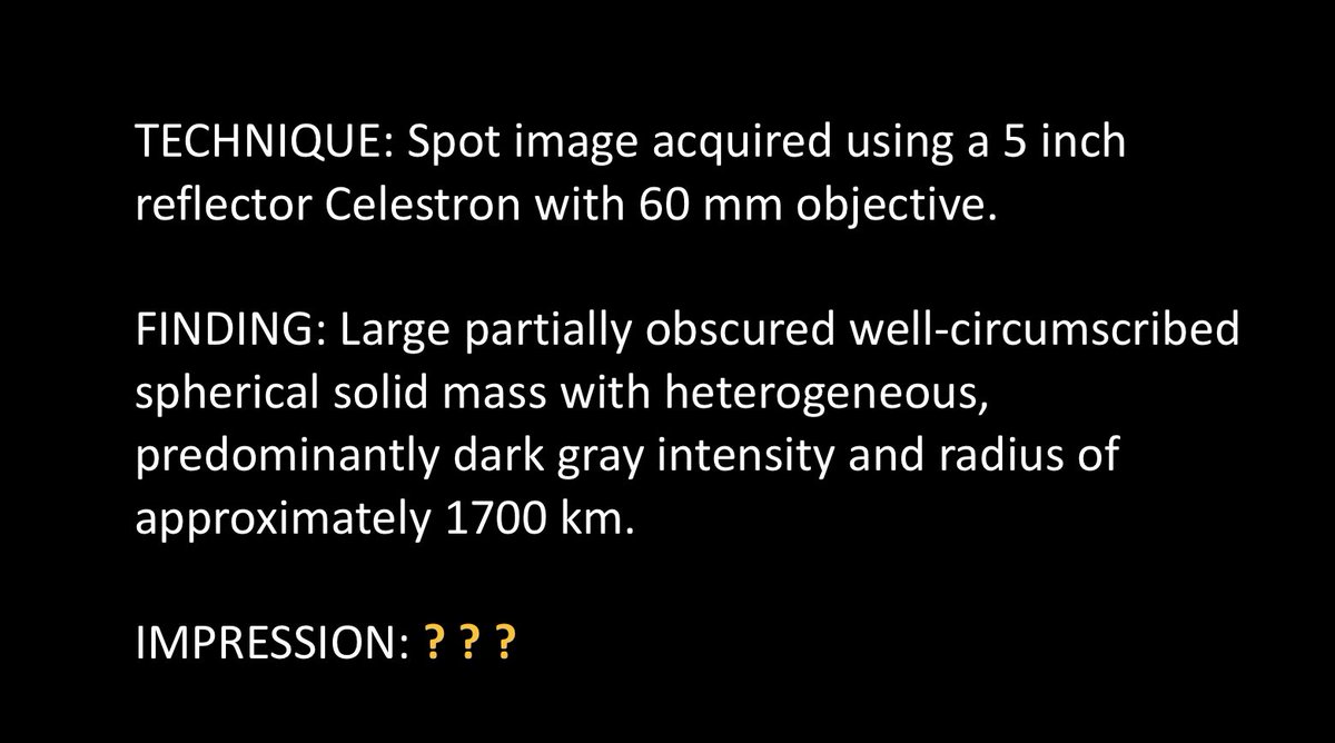 PBalthazarMD's tweet image. Our reports, like any product, should continuously improve over time. Learned a lot about the report of the future from @LesFolio @sethb_md @ DavidKwan. Check out the virtual recording if you were not able to attend it in person #RSNA21