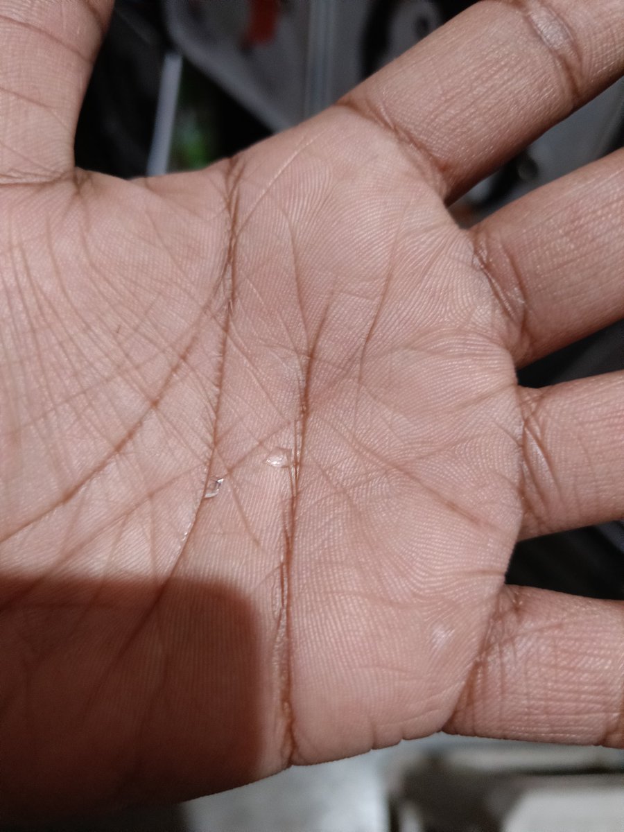 timmykansal's tweet photo. Height of consumerism and brand loyalty for huge brands like Unibic. Today my little sister almost swallowed 2 shards of glass in a packed Unibic biscuit. She got her mouth also cut and had vomitted. I tried contacting on Unibic consumer care number ( alas both are not working) https://t.co/zPbB5cApN5