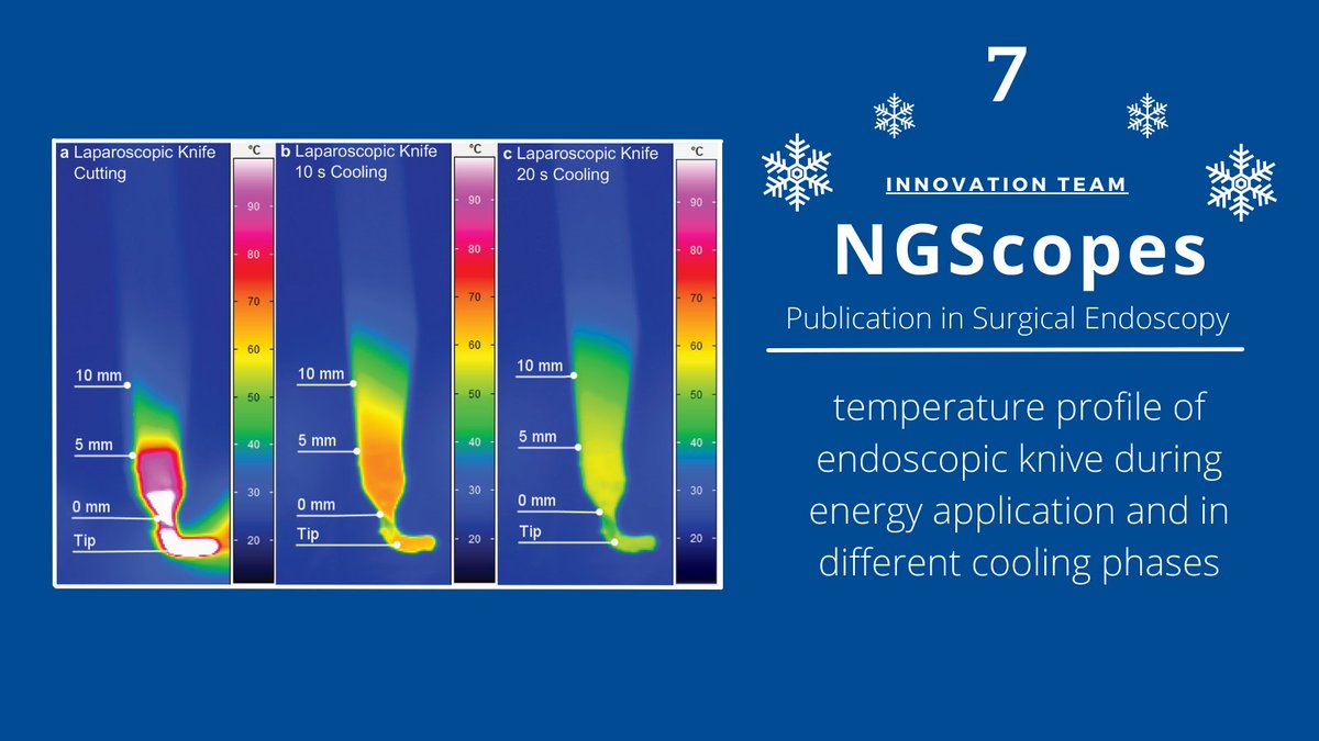 EKFZdigital's tweet photo. 🗓️7⃣ Detailed insights about the temperature profile of endoscopic knives are lacking. NGScopes and @IPFDD 👨‍🔬👩‍🔬 investigated the temperature of electrosurgical devices to increase safety in handling. Read full article in #SurgicalEndoscopy @SpringerNature https://t.co/N6lWskWXwM https://t.co/HbTAXOl7VJ