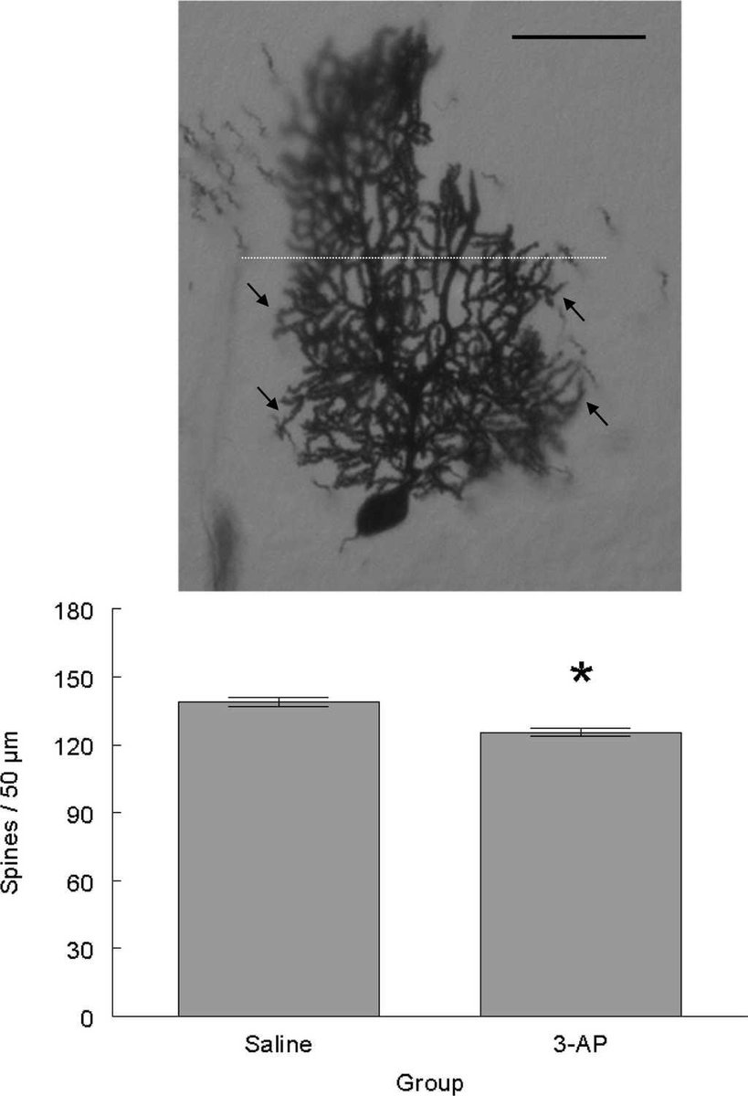 RevNeurologia's tweet photo. 3-Acetylpyridine-induced ataxic-like motor impairments are associated with plastic changes in the Purkinje cells of the rat cerebellum https://t.co/Jq3Hkp5jp3 https://t.co/oRwJTLhF5J