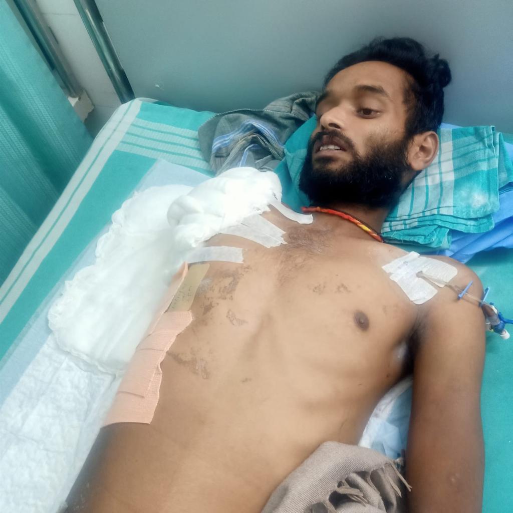 In a gruesome incident, police torture has led to the amputation of a boy accused of petty theft.

When law &amp; order is absent, jungle raj becomes the norm.

<a href="/CMofKarnataka/">CM of Karnataka</a> &amp; Home minister should take the responsibility, suspend the inspector  and order for fair enquiry.
