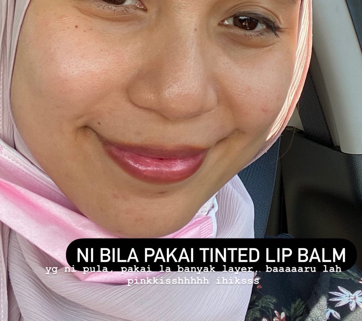 atiqahyahaya_'s tweet photo. Moisturizing Lip Balm & Tinted Lip Balm by @skineats_ on my lip.
#YourLipsNeedLoveToo https://t.co/iOzpGb1n4p