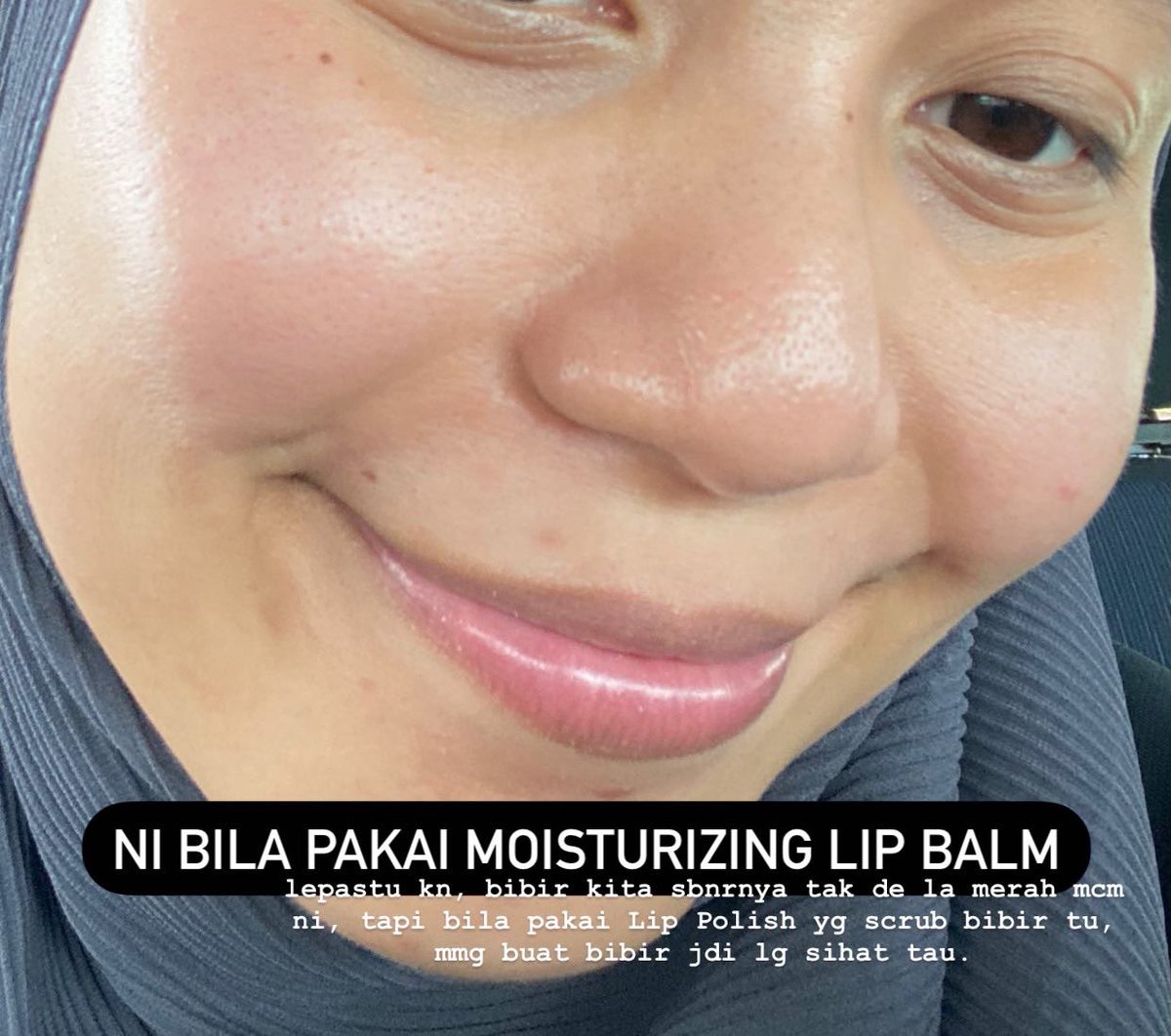 atiqahyahaya_'s tweet photo. Moisturizing Lip Balm & Tinted Lip Balm by @skineats_ on my lip.
#YourLipsNeedLoveToo https://t.co/iOzpGb1n4p