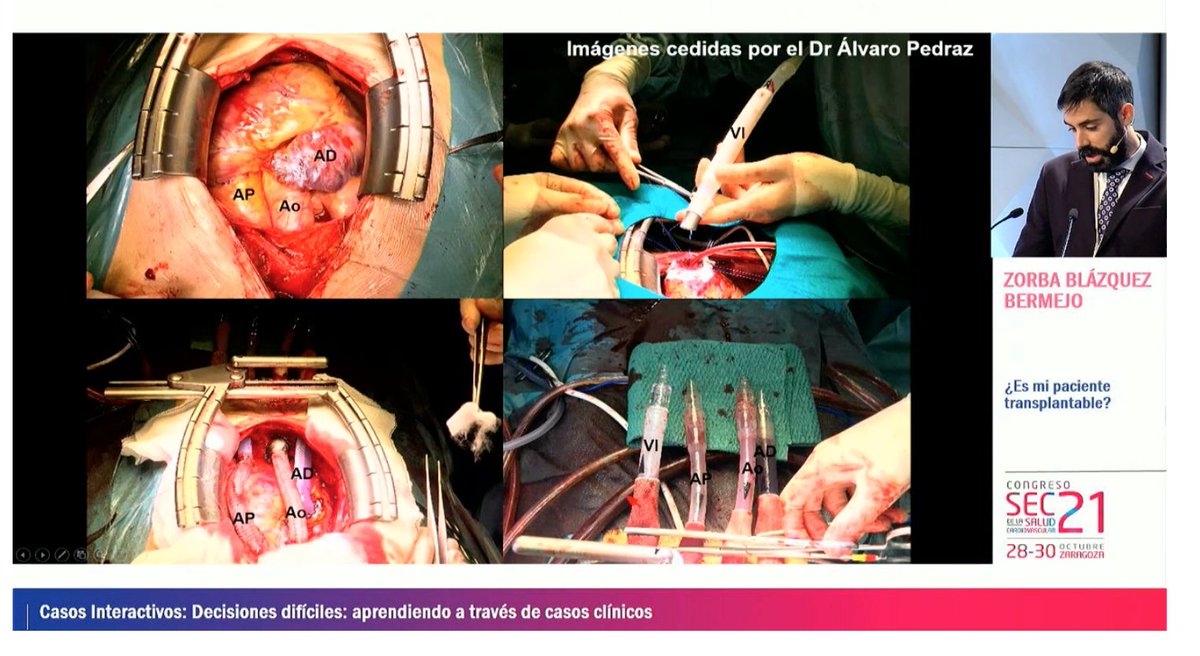 davidcalle1390's tweet photo. #SEC21 #SEConline
✅Sesiones interesantes
✅Charlas que te perdiste
✅Presentaciones y datos
✅Casos interactivos
👨💻Algo bueno hemos sacados de este año y medio "online" que nos ha tocado vivir🦾
@secardiologia @diez_villanueva @almucastro01 @rafavidalperez @jvillacastin https://t.co/ZLDCEVgTCS