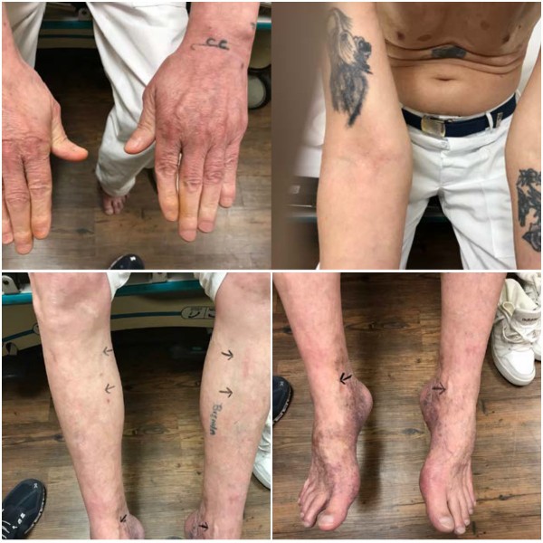 WebDPN's tweet image. #USA | Recent cases demonstrate the ordinary cruelty of capital punishment deathpenaltynews.blogspot.com/2021/12/usa-re… #deathpenalty #botchedexecution #PervisPayne #DoyleHamm #Alabama