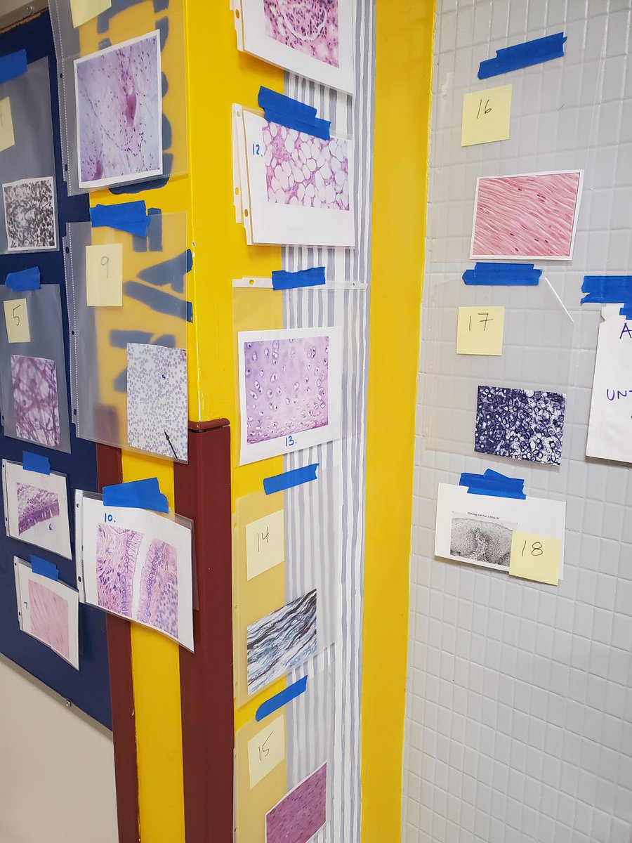 DebClapp1's tweet photo. It's that time of year again...
NO! Not the Holidays, but Hallway Histology Time! #pathology #tissues #histology #makingdoctors #Anatomy https://t.co/iIMSmeg9Qm