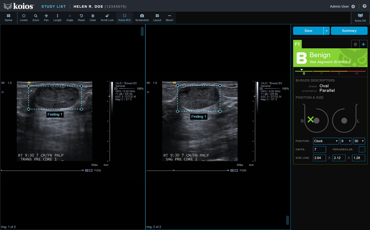 MedTechNow_'s tweet photo. #regulatory #news 

~FDA clears #CoreLink's CentraFix midline fixation system

~@reflexionmed nabs breakthrough device designation for #LungCancer treatment 

~Canada approves @KoiosMed #AI-driven, #breastcancer #ultrasound #software https://t.co/T7MBoq57kY