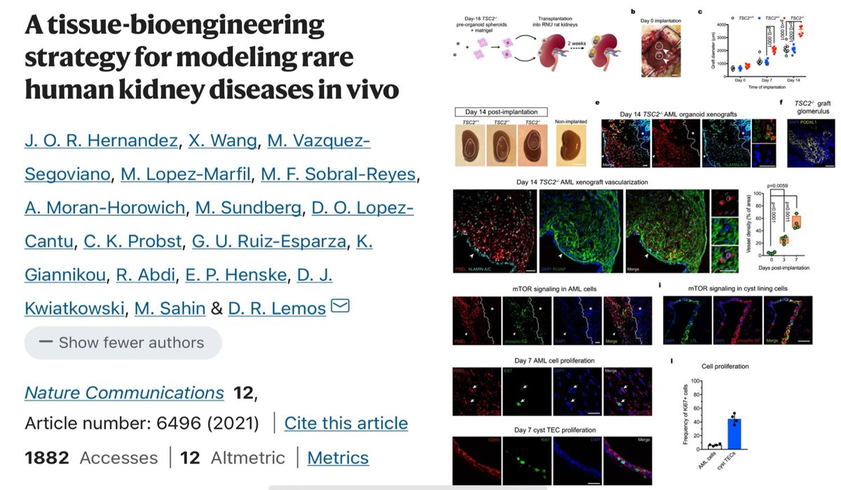 DrRuizEsparza's tweet photo. Comparto una de nuestras recientes publicaciones y colaboraciones que somos parte, publicada en Nature Communications, el Dr. Dario Lemos y su grupo de #Harvard Med lideran nuevas estrategias de bioingeniería para modelar enfermedades renales raras. https://t.co/Tci0H34uGB https://t.co/R9Z11M2BeV