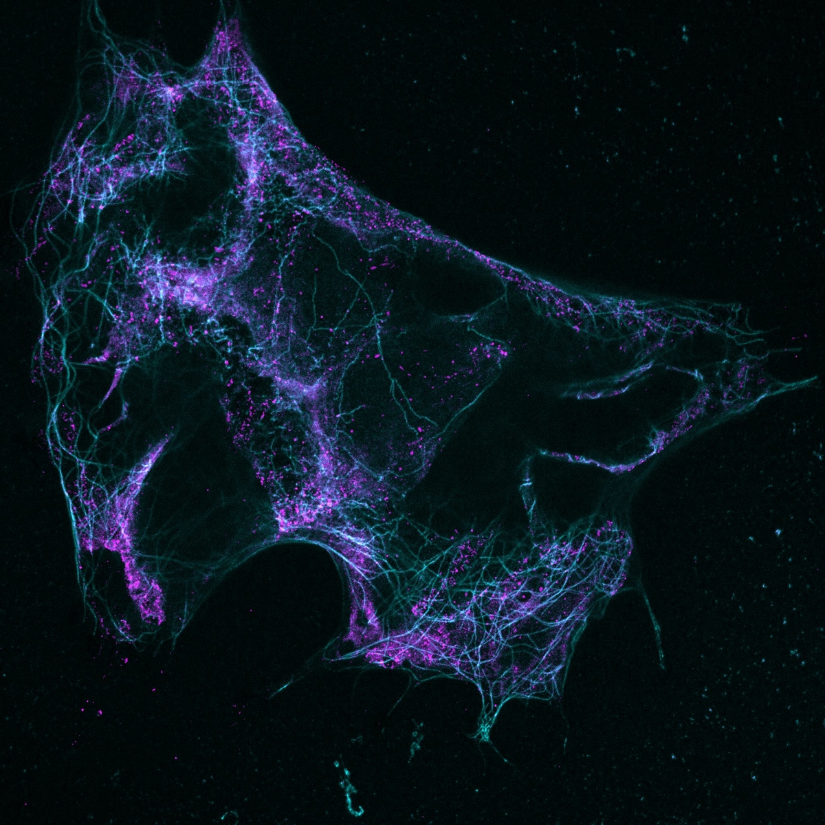 imag_ic's tweet photo. #FluorescenceFriday by Julie #SRmicroscopy #STED fibroblasts cell STAR580_Tubulin STAR635P_Clathrin @InstitutCochin https://t.co/Jn6ygVZjzx