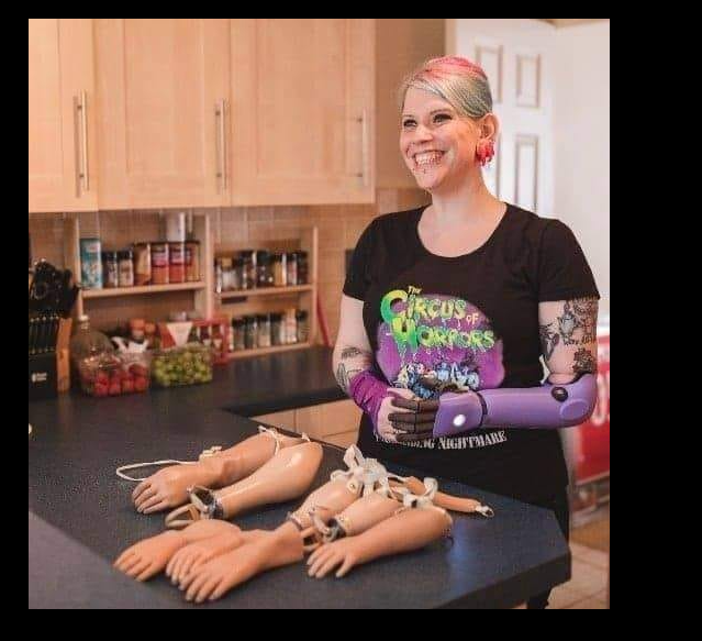 openbionics's tweet photo. Hero Arm users started a then and now thread of their devices. #ProstheticInnovation @NHSX @NHSEngland https://t.co/JhdxQ9smvN
