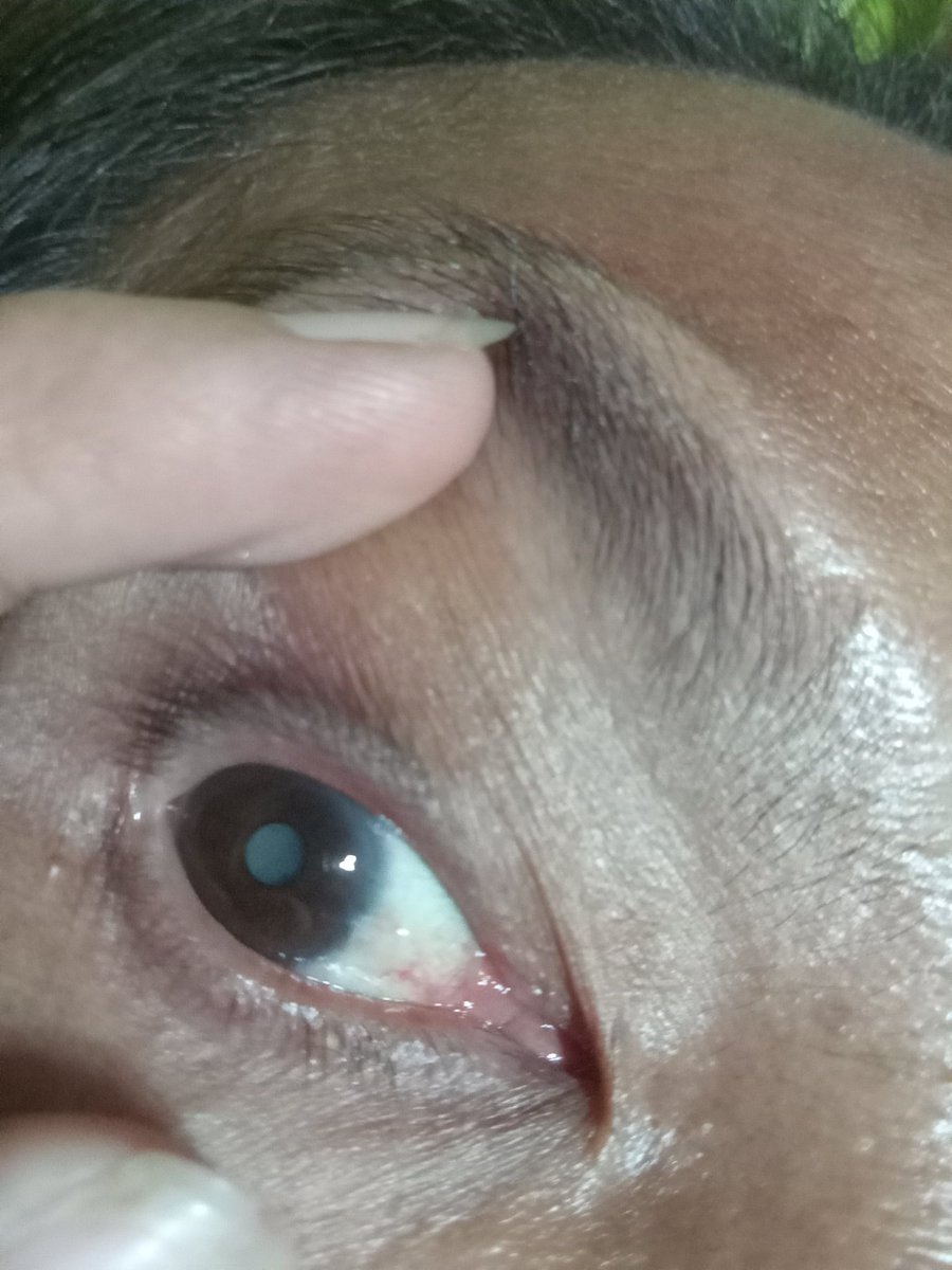 JaycelPublico's tweet photo. [Not SB19 Related] 
Hihingi lang Po sana ako Ng kunting tulong Mula sa mga Co a'tin ko dyan baka lng may mga piso kayu dyan na maitutulong sa akin😭 pandagdag lang sa pambili Ng gamot Ng nanay ko pls if you can see this RT this post napakalaking tulong na 
Gcash :09635241169 https://t.co/BPLT0nK3RV