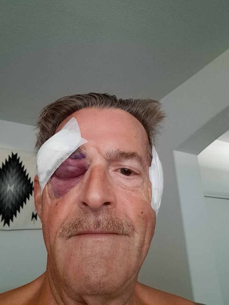 haappyy's tweet photo. You should see the other guy https://t.co/E8r8QDaeGS