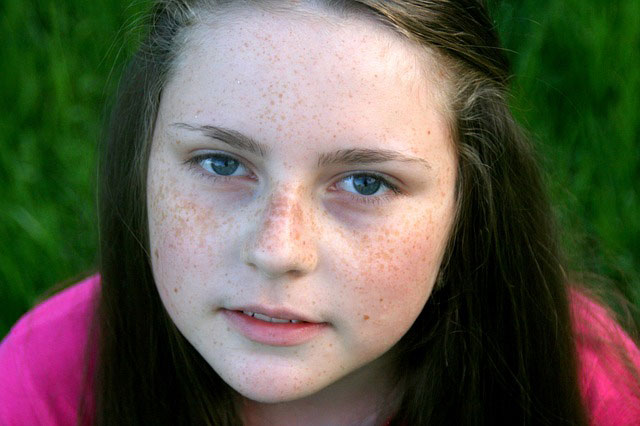 Freckles Are Linked To Genetic Variation

Ever wonder why some people get freckles? It has a lot to do with our skin's sensitivity to sunlight, which is mediated by our genes.

#AreFrecklesGenetic
#frecklesgeneticvariation
#freckles

genomelink.io/traits/freckles