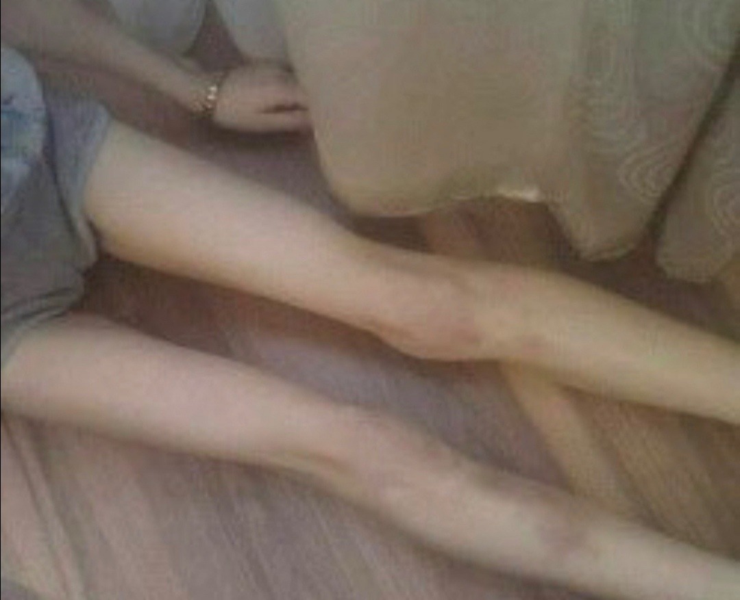 ezthys's tweet photo. would do anything for those legs
#edtwt #thinspo https://t.co/F91tLeI5cW