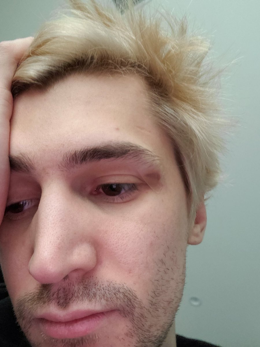 xQc's tweet photo. DECIDED TO WAKE UP AND FIGHT THE WOODEN DRESSER AND GOT CLAPPED. GOOD MORNING https://t.co/uQ0txByWSU