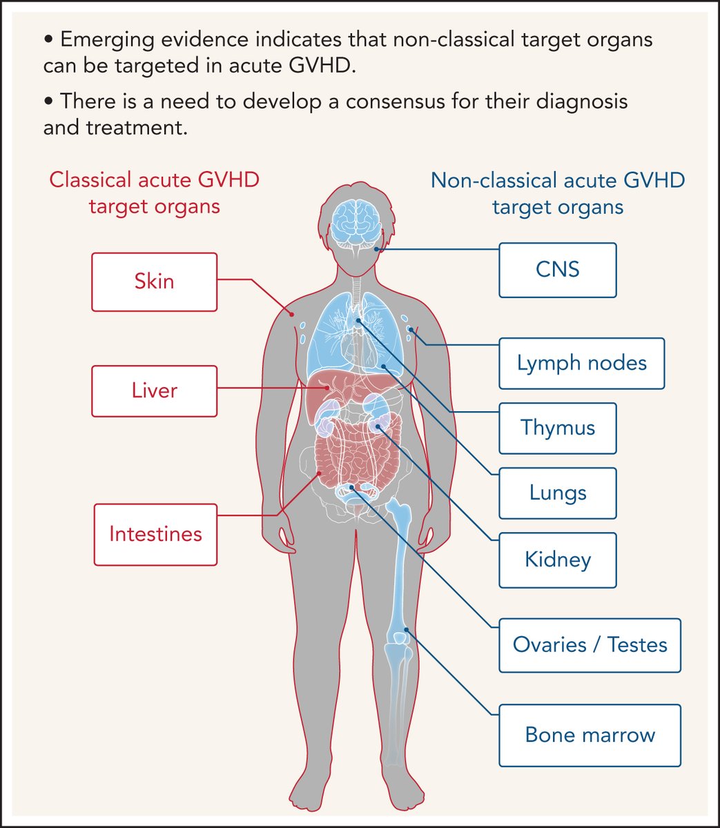 Nonclassical manifestations of acute #GVHD loom.ly/skDwqcs