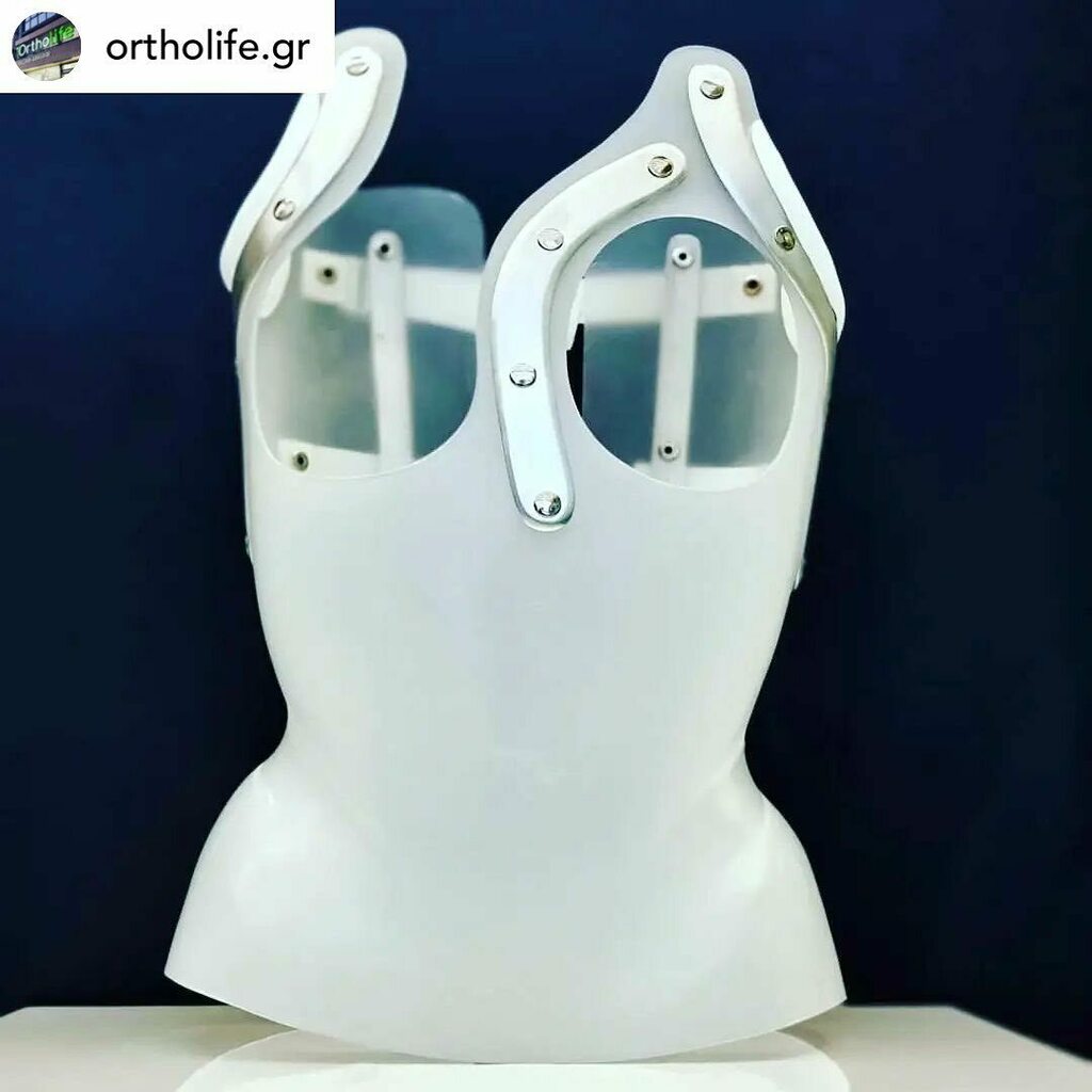 3dheals's tweet photo. #repost @ortholife.gr 3D Printed Scoliosis Braces!
#3dprinting #3dprinted #3dprinter #scoliosis #orthopaedic #orthotics #orthopedic #ortholife #medical #wellbeing #braces #scoliosisexercise #scoliosisawareness #scoliosisbrace #greece #technology #braces #ddb #dynamic #derot… https://t.co/L6P5wKftr4