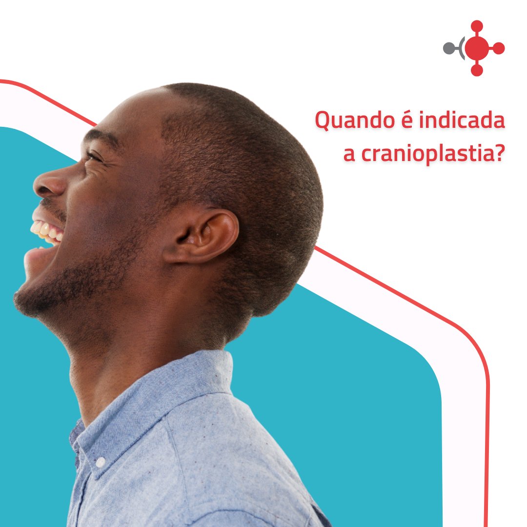 CustomizeLifeMD's tweet photo. Existem, basicamente, três indicações para se realizar uma cranioplastia:
  
🤕 Restabelecimento da proteção contra traumas; 
💀 Recuperação do contorno craniano;  
💆‍♂️ Tratamento da síndrome do trefinado. 

Contate-nos para atendermos a sua necessidade: 📲 +55 (48) 99954-0882. https://t.co/6OHzirKWtl