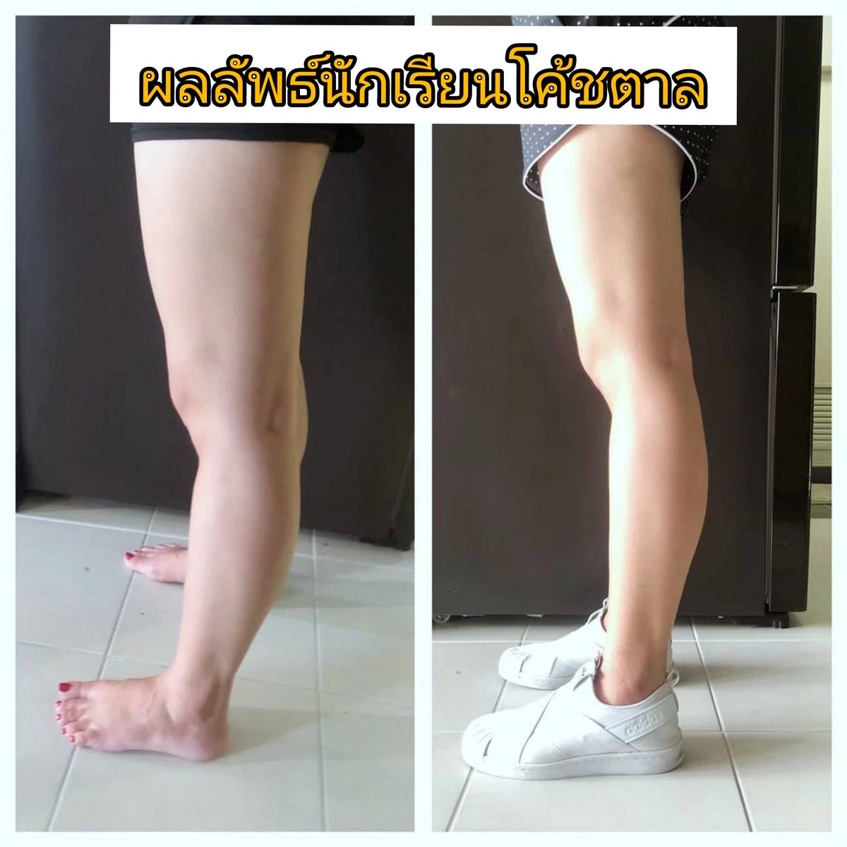 coachtarn's tweet photo. มื้อโกงทานได้ แต่ อย่าทานบ่อย เพราะจะทำให้ไขมันลดยากมากๆน้าค้าา 

ติดตามเคล็ดลับดีๆ ทานอย่างไรให้ผอม ที่ Line @coachtarny หรือ TW นี้ได้เลยค้าา 

#ลดน้ําหนัก #ลดน้ําหนักแบบไม่แดกยาโว้ยย #ลดความอ้วน #ลดขา #อ้วนแซ่บ #อ้วน #ลดไขมัน https://t.co/DdqKETKGnS