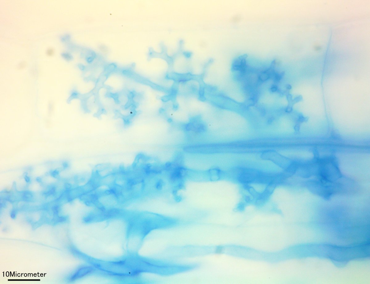 takeshi_sentoku's tweet photo. シュンギク(Glebionis coronaria)の根のarbuscule。
アーバスキュラー菌根菌はsporeもarbusculeも美しい。
#菌根菌 #mycorrhiza #arbuscule https://t.co/MvbadV24tz
