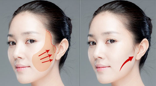 beautyplatform's tweet photo. Latest Aesthetic Breakthroughs Unveiled: https://t.co/rrtyUZbH9x

#aestheticmedicine #antiaging #facelift #beautyblog https://t.co/lnkzFxlyoA