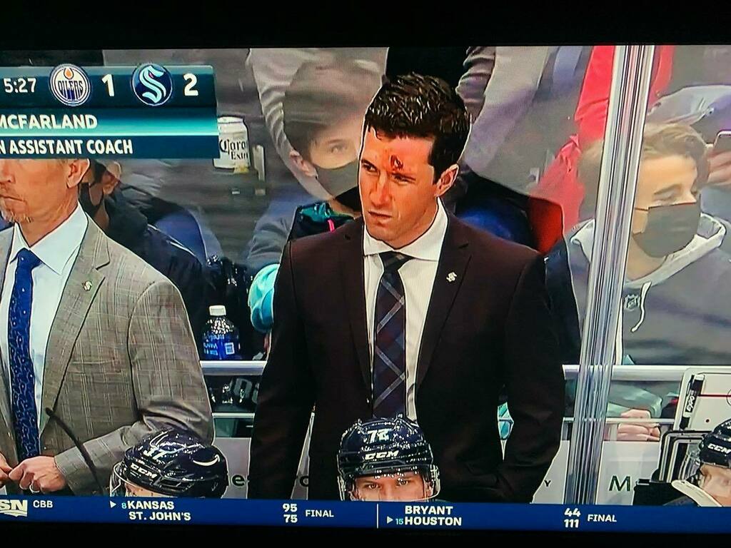 Even #hockey coaches are tough! Check out Paul McFarland who took a puck to the face on Friday night and stayed on the bench 😱 #hockeytough