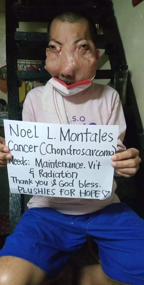 Time Sensitive Please help us share and donate if you can!! 🙏

Please help us raise 20,000 pesos ($400) for Tatay Noel, 53 years old. He was diagnosed with Chrondosarcoma and funds will be used for his lab request. (Radiation and baseline endoscopy) maintenance cost 3,000/month+