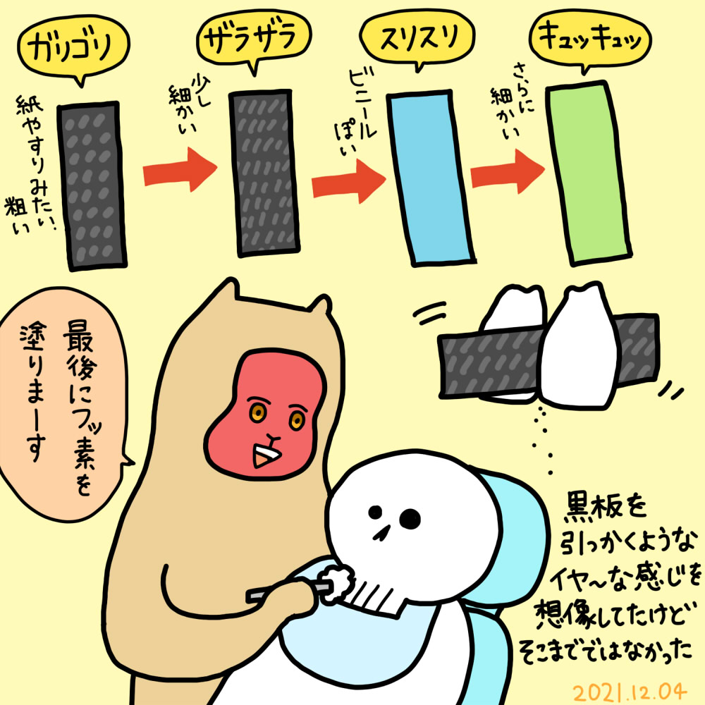 2021年12月4日(土) 1ヶ月ぶりの矯正歯科 歯と歯のあいだを削ってスペースを作る処置(IPR)をしてもらったよ あと矯正装置のワイヤーがゴールドでかっこよくなったので見てください 上のワイヤーの曲げた部分が元に戻ろうとする力を利用して歯を動かす…?らしい(うろおぼえ)
