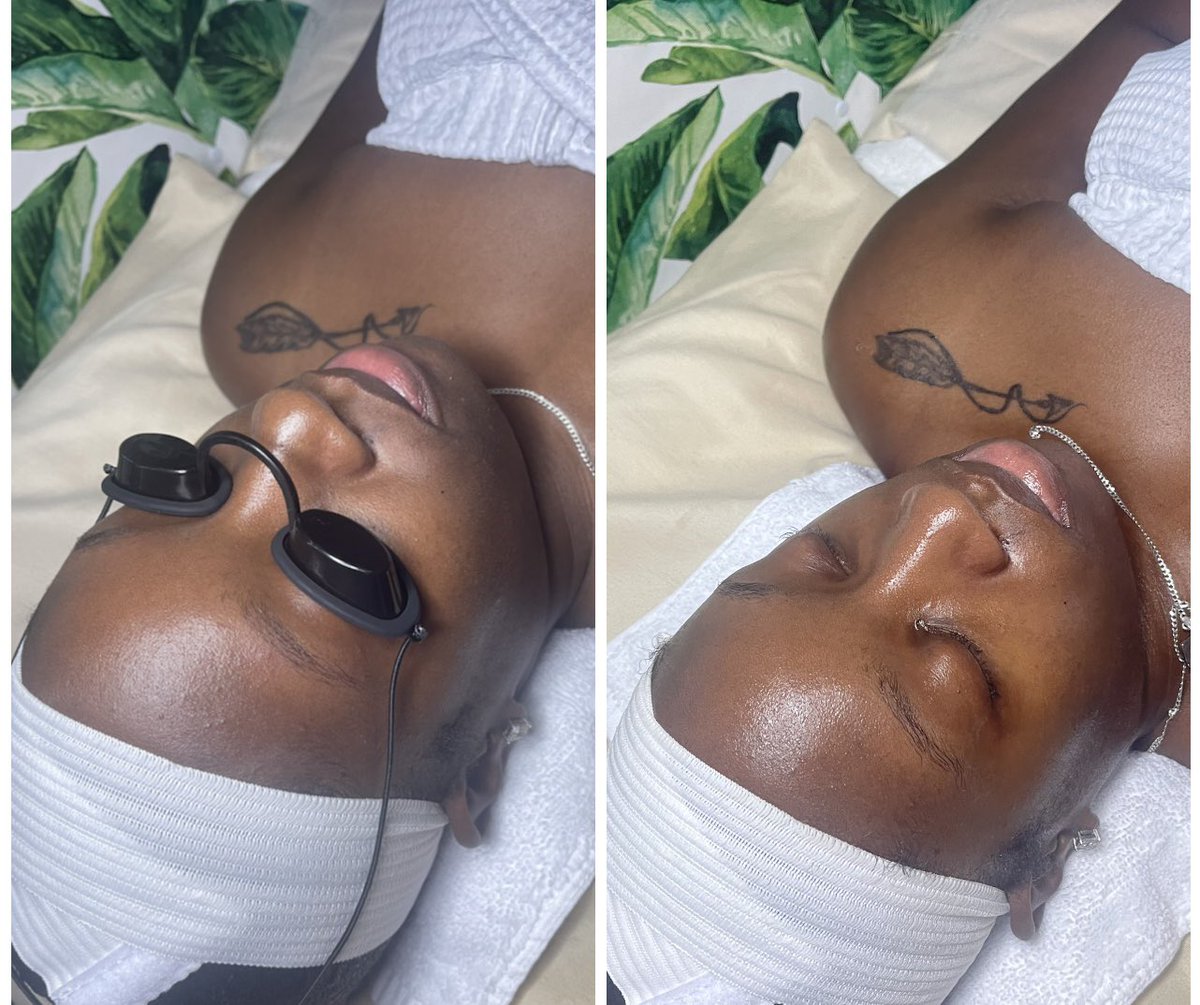 Before &amp; After 🤗