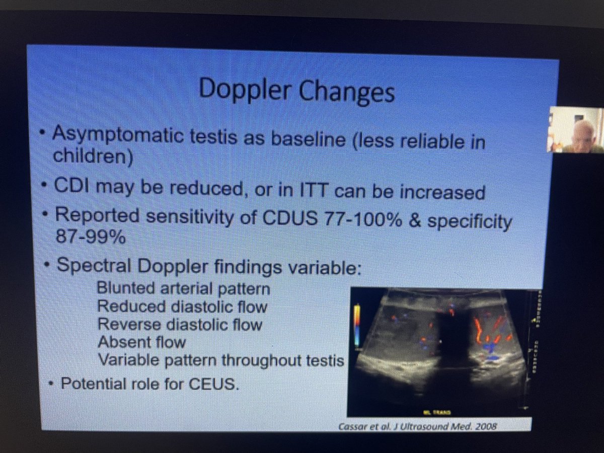 BMUS_Ultrasound's tweet photo. Dr James Pilcher discussing the role of #ultrasound in testicular torsion #WhirlpoolSign #ASM21 #Ultrasound2021 have you joined us this Saturday morning? If you registered don’t worry it’s available on demand! https://t.co/zBGrPoAjor