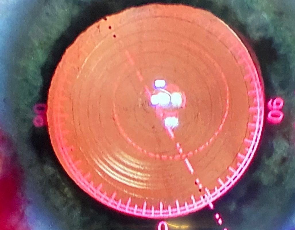 DrRobMelendez's tweet photo. 👁 Imagine having a futuristic image showing up in your view through your oculars during Cataract Surgery and Refractive Lens Exchange. The future is now at the Juliette Eye Institute. @alconlife #ORA #Aberrometery #luxorrevalia #panoptimist #panoptixtrifocaltoricIOL https://t.co/d8Yl0flWob