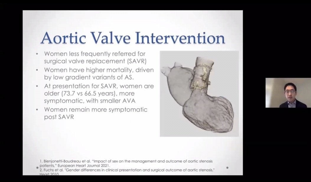 Renée Bullock-Palmer MD FACC FAHA FASNC FASE FSCCT (@rbp0612) on Twitter photo Great talk by <a href="/jameschilee/">James Lee</a> from <a href="/HenryFordNews/">Mohammed Israil</a> on use of Cardiac CT in SHD planning in Women
at this morning's 8th annual <a href="/demanddeborah/">Deborah Heart and Lung Center</a> and <a href="/cvi_phila/">Cardiovascular Institute of Philadelphia</a> role of cardiac imaging in women #DHLCVI21. Great talk by <a href="/jameschilee/">James Lee</a> from <a href="/HenryFordNews/">Mohammed Israil</a> on use of Cardiac CT in SHD planning in Women
at this morning's 8th annual <a href="/demanddeborah/">Deborah Heart and Lung Center</a> and <a href="/cvi_phila/">Cardiovascular Institute of Philadelphia</a> role of cardiac imaging in women #DHLCVI21.