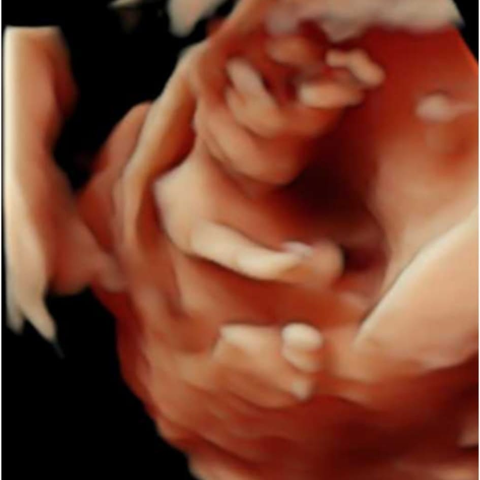 Juanma_rbb's tweet photo. Qué regalo más grande, qué alegría más transparente esto de ser padre. Nora, tu madre y yo te esperamos con la impaciencia del que sabe que entre sus brazos encontrarán el más sentido reflejo de la palabra amor. https://t.co/QbQBTvBGWG