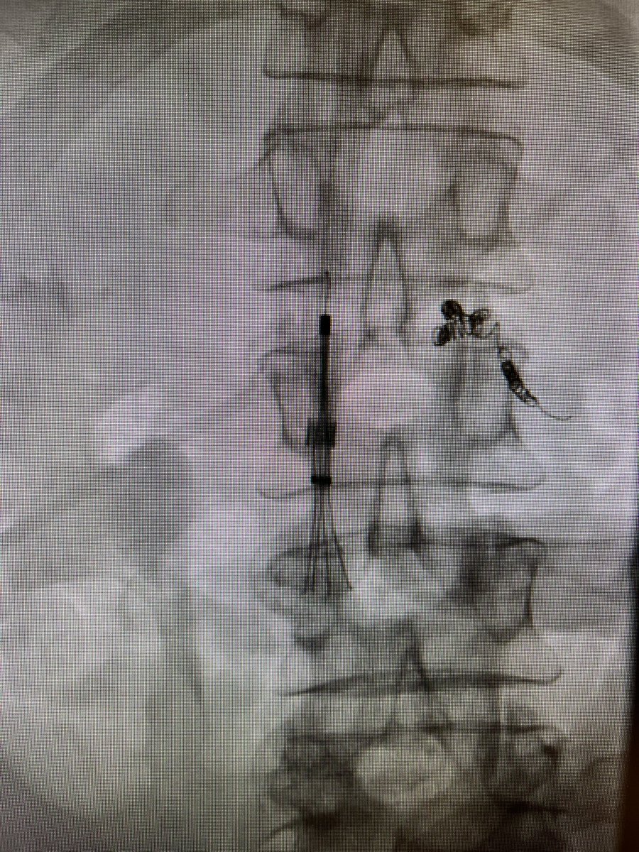 Brian Park MD, MS, CIIP tweet media