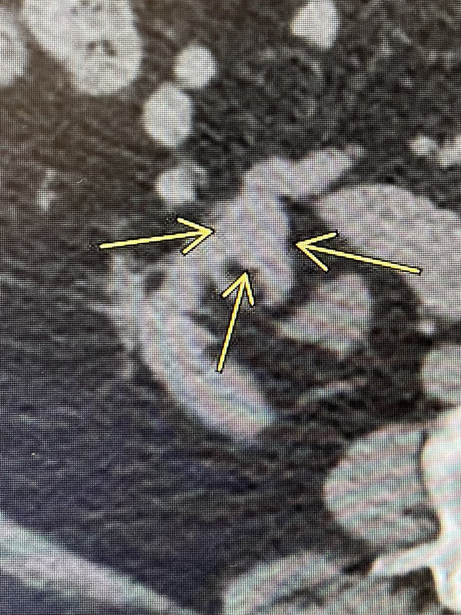 Brian Park MD, MS, CIIP tweet media