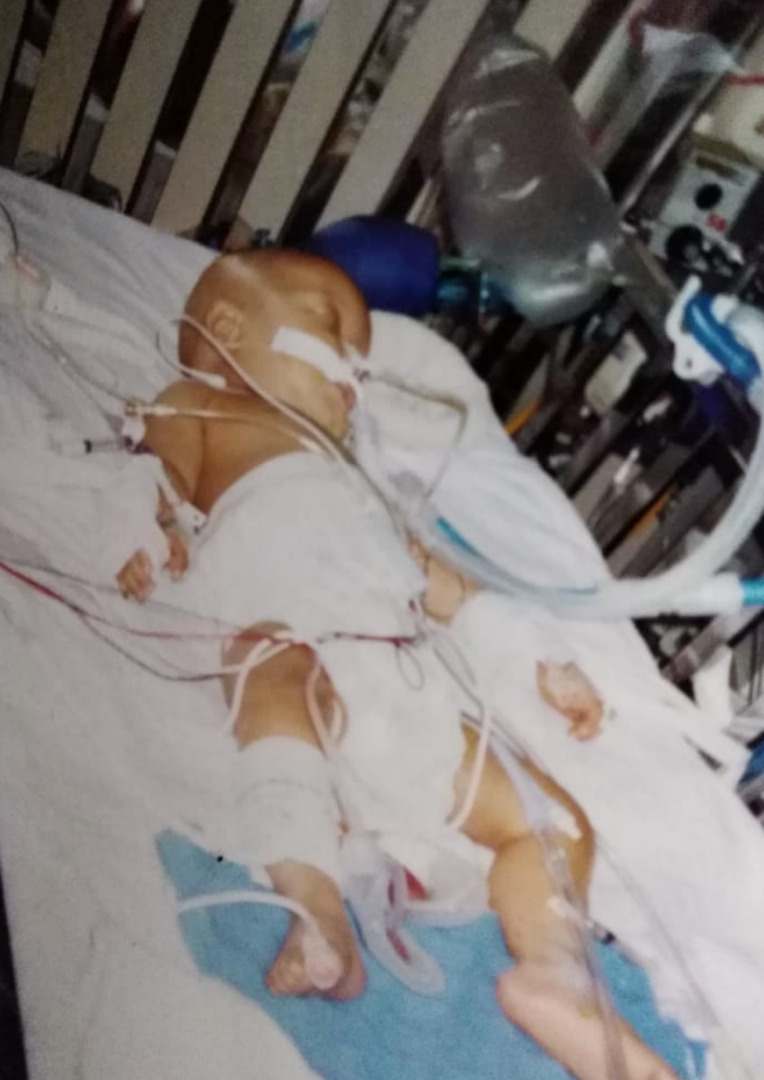 Jarr1259's tweet photo. Yo un día en el 98 luchando contra el cáncer despues de que me quitaran el 80% del hígado. Yo un día en el 2021 saliendo de un turno de la ciru. 

La vida a veces cansa, duele, difícil, es molesta y no es coherente... sin embargo, la vida es HERMOSÍSIMA♥️💕💞 😎🤙 https://t.co/W5PioYhcFq