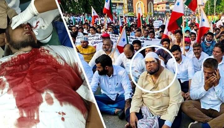 AleemIlahi's tweet photo. This is brother Sayyad Athoor Thangal from Mangalore. Just two days back, he was brutally assaulted by Mangalore police. Today, he is back on the street, at the forefront of the struggle, right from the hospital. @PFIkarnataka protest. https://t.co/GOAIfhZYUH